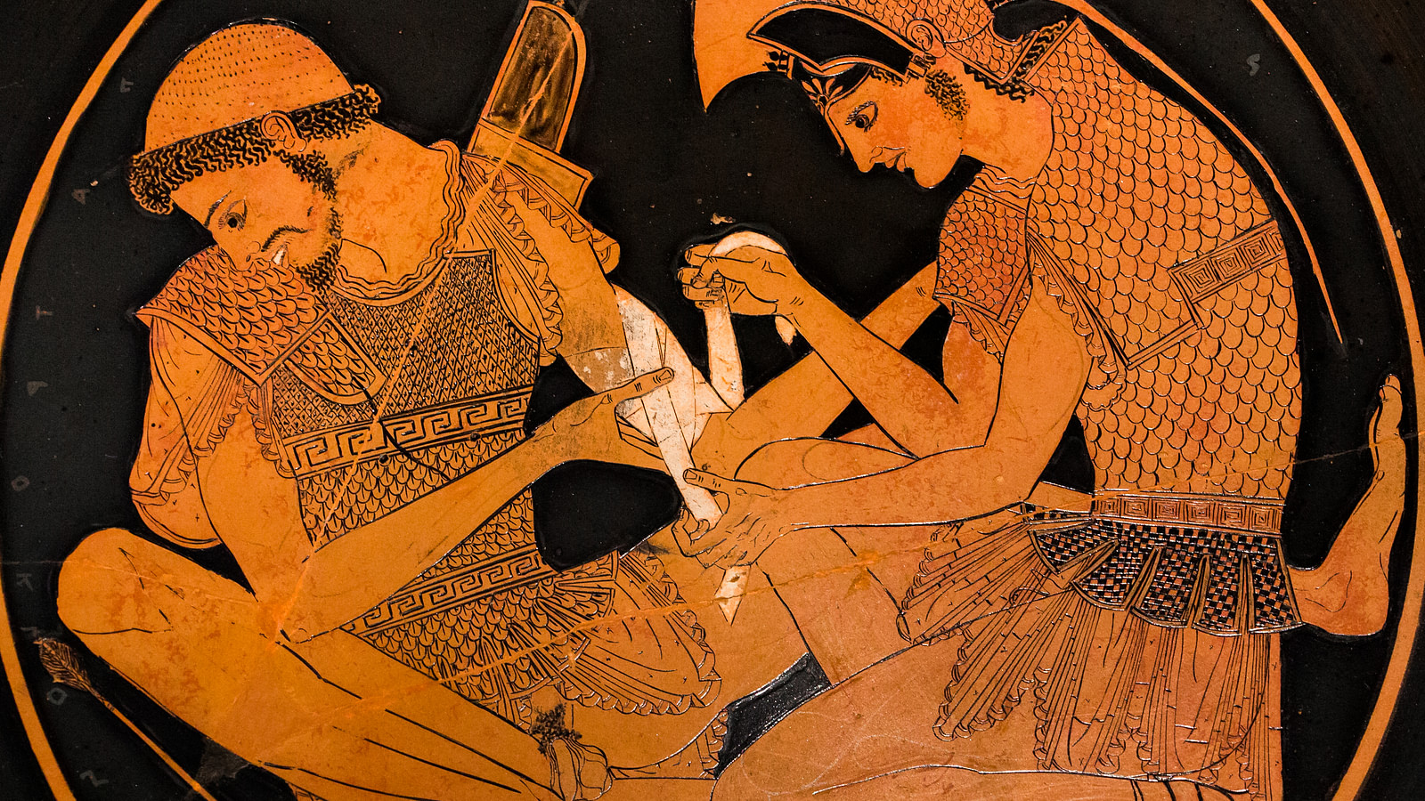 What Did Achilles Look Like: A Conclusive Report
