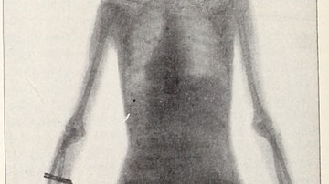 Early X-ray