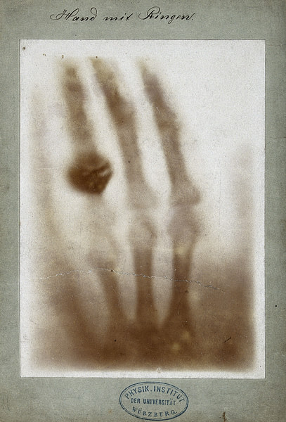 First Medical X-Ray