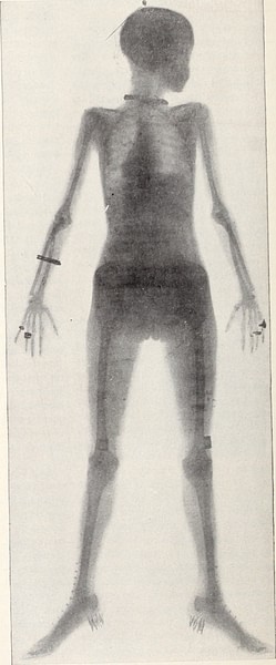 Early X-ray