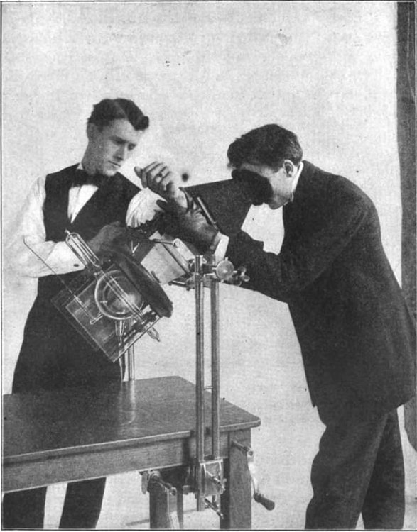 X-Ray Procedure Using a Fluoroscope